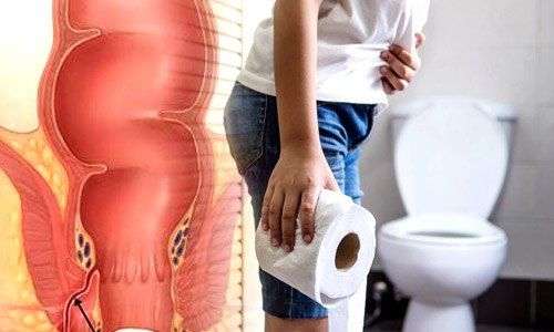 piles specialist near me, hospital for piles near me, piles hospital near by me, piles hospital near me, proctologist near me, piles clinic near me, piles doctor, piles doctor in indore, piles dr in indore, best piles doctor in indore, proctologist in indore, piles specialist doctor in indore, piles clinic in indore, best doctor for piles in indore, piles specialist in indore, piles treatment in indore, what is piles problem