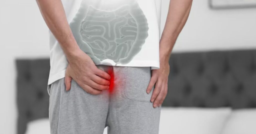 fistula treatment in Indore
